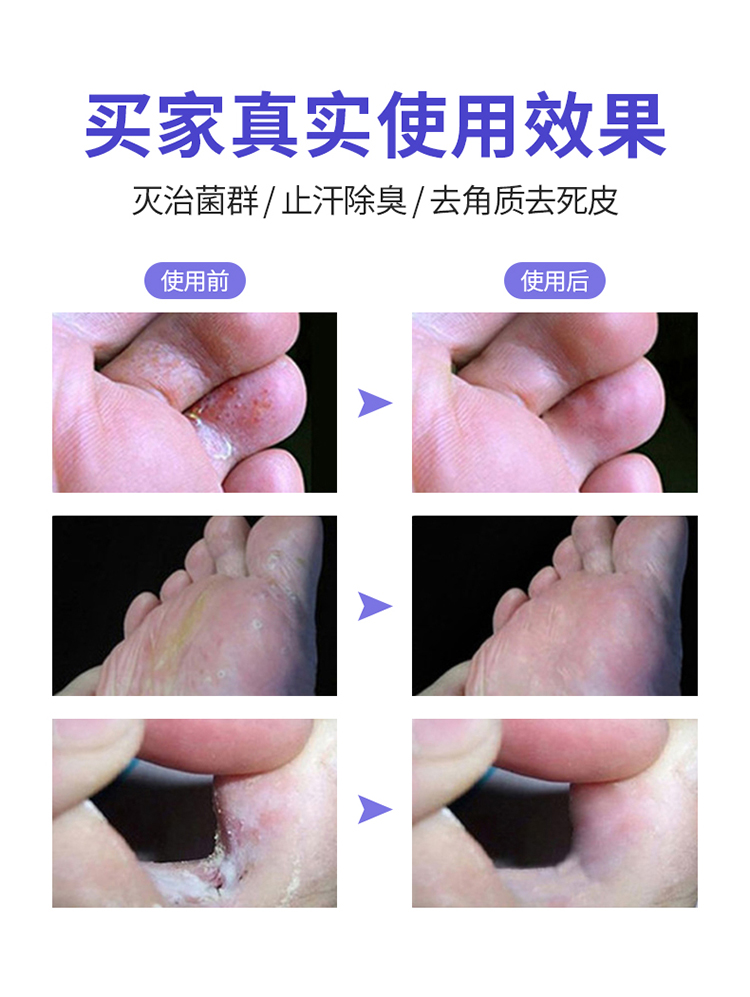 龙源足光丸